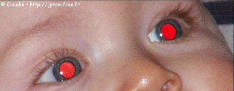 yeux rouges