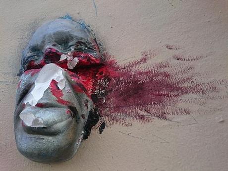 teteblessee.jpg, oct. 2016 teteblessee.jpg