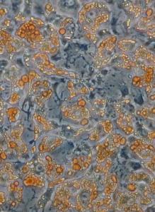 OBÉSITÉ: Graisse blanche, graisse brune, ce n'est pas qu'une question de couleur! – Cell Reports