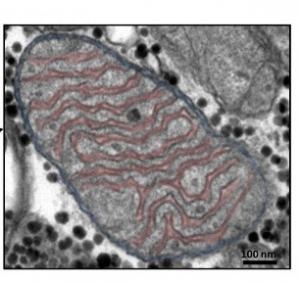 SANTÉ MUSCULAIRE: Pourquoi la qualité du muscle prime sur la quantité – The Journal of Physiology SANTÉ MUSCULAIRE: Pourquoi la qualité du muscle prime sur la quantité – The Journal of Physiology