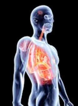 Le curcuma stoppe efficacement l’asthme et la bronchite cancer_poumon