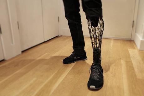 Une prothèse en titane imprimée en 3D