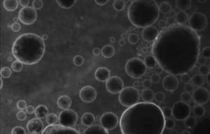 PHARMACOCINÉTIQUE: Des bulles lipidiques pour franchir la barrière hémato-encéphalique  – Journal of Cerebral Blood Flow and Metabolism