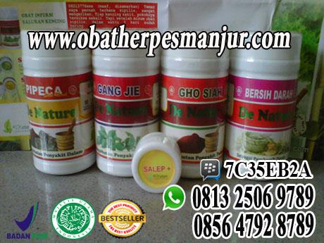 cara mengobati Herpes cara mengobati Herpes