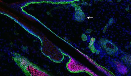 GREFFES et PEAU et CICATRISATION: Poils et sueur, 2 facteurs essentiels – Science