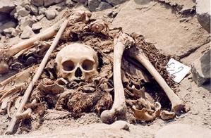 Malade atteint d’une maladie grave… tu peux crever ! Malade atteint d’une maladie grave… tu peux crever !