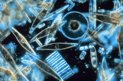 Microscope image of phytoplankton