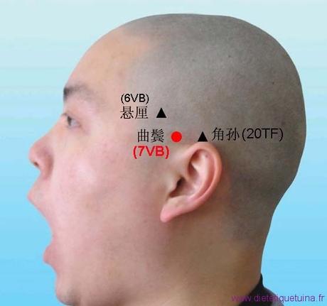 Le point Qu Bin du méridien de la vésicule biliaire (7VB)