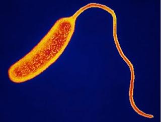 #thelancet #choléra #Vibriocholerae #épidémie #endémie Séminaire – Choléra
