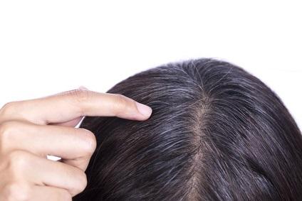 DIAGNOSTIC : Les cheveux gris, un signe cutané du risque de maladie cardiaque – EuroPrevent 2017