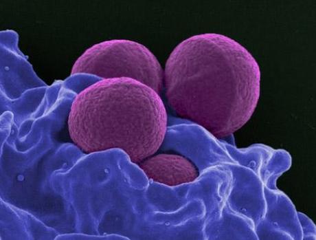 QUORUM SENSING : Le revêtement de surface qui sait parler aux bactéries – Nature Microbiology