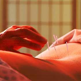 Remede mal au dos - acupuncture Remede mal au dos - acupuncture