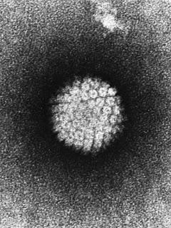 #thelancet #HPV #vaccin9valent Analyses d’efficacité finale, d’immunogénécité et d’innocuité du vaccin papillomavirus 9-valent chez des femmes âgées de 16 à 26 ans : essai en double-aveugle, randomisé