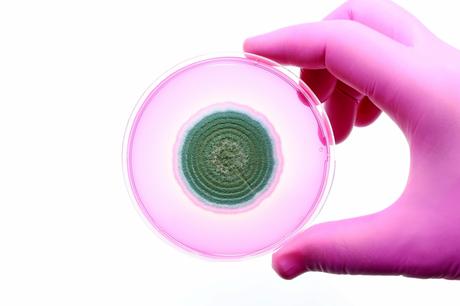 C’est un nouveau type de traitement capable de « battre » le champignon (Visuel Adobe Stock 616026780) C’est un nouveau type de traitement capable de « battre » le champignon (Visuel Adobe Stock 616026780)