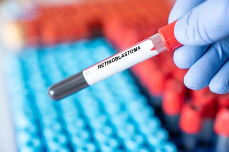 Cette équipe du Children’s Hospital Los Angeles,  s’apprête à lancer la toute première étude internationale sur le recours à la biopsie liquide pour le diagnostic, la surveillance et l’évaluation de la réponse au traitement du rétinoblastome (Visuel Adobe Stock 585322164)