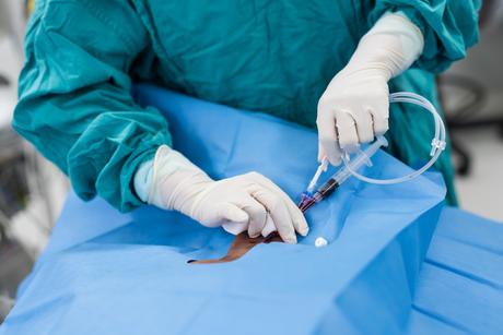 Le cathétérisme c’est une vraie spécialité (Visuel Adobe Stock 113461339) Le cathétérisme c’est une vraie spécialité (Visuel Adobe Stock 113461339)