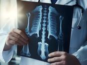 SCANNERS risque cancer sang