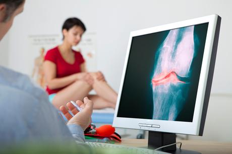 C’est l’espoir d’un tout nouveau protocole de réparation de l'arthrite, complètement curatif, pour les millions de patients atteints dans le monde (Visuel Adobe Stock 158960700)