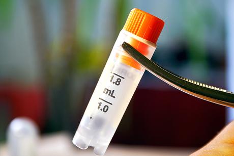 Oui, les suppléments à base de fécule de pomme de terre pourraient être une solution contre les complications des greffes de moelle osseuse (Visuel Adobe Stock 143338323) Oui, les suppléments à base de fécule de pomme de terre pourraient être une solution contre les complications des greffes de moelle osseuse (Visuel Adobe Stock 143338323)