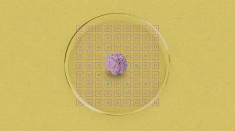 Les organoïdes cérébraux montrent un potentiel pour une nouvelle génération de bio-ordinateurs