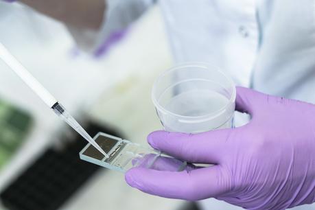 Cette large analyse alerte sur l’association entre l’exposition aux insecticides et une concentration plus faible des spermatozoïdes chez les hommes adultes (Visuel Adobe Stock 251608643) Cette large analyse alerte sur l’association entre l’exposition aux insecticides et une concentration plus faible des spermatozoïdes chez les hommes adultes (Visuel Adobe Stock 251608643)