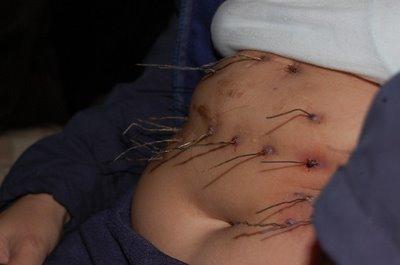 Une anomalie qui demeure mystérieuse