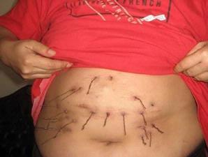 Une anomalie qui demeure mystérieuse