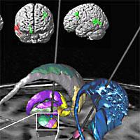 imagerie-fonctionnelle-cerebrale.1229524832.jpg