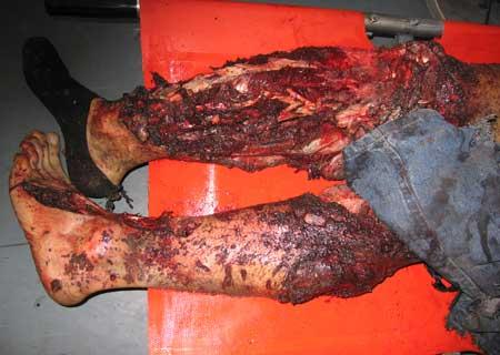 Des Armes Non Conventionnelles Utilisées Contre Les Gazaouis