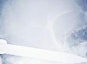 homme survit après avoir poignardé tête