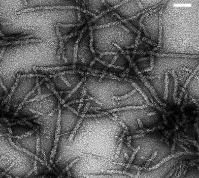 Prion. Illustration.