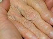 Nouvelle cible médicamenteuse pour traitement l'arthrite