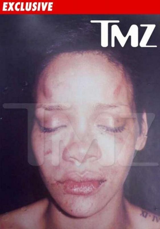 Le visage de Rihanna après l'agression