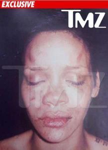TMZ sort la photo de Rihanna battue