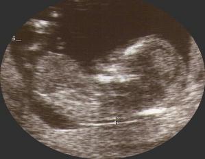 Et parce qu'un bonheur n'arrive jamais seul ...