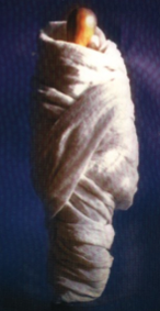 Packing: usage de sac de contention pour les enfants autistes