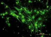 espoir réaliste pour SEP. (CNRS)