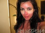 Kardashian pris coup soleil