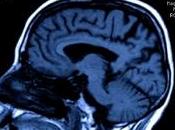 Épilepsie prédire maladie avant même premières crises