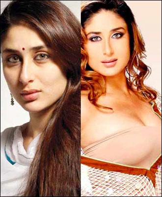 Les stars de Bollywood qui ont subi une chirurgie esthétique