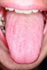 langue et bouche