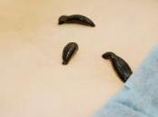 sangsue dans pendant