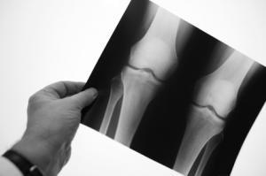 Radiographie (illustration)