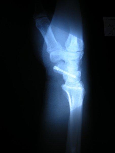 Ce qui nous traverse