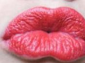 Kestion Passikon (#29)