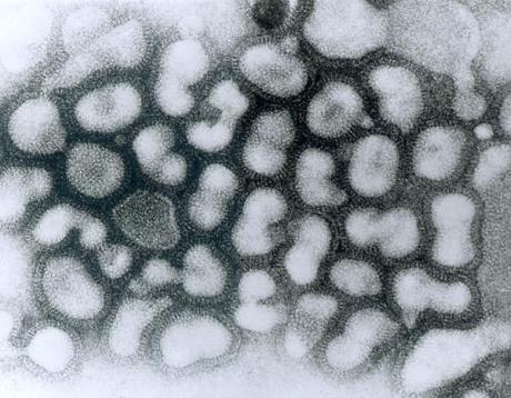 grippe aviaire virus Les symptômes de la Grippe A H1N1