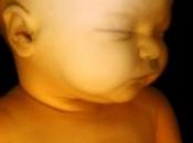 Après l'échographie, foetus pour futures mères, découvrez images