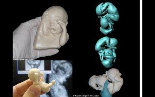 Imprimer votre Bebe en 3D