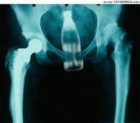 274°  La justice des uns et la justice des autres.