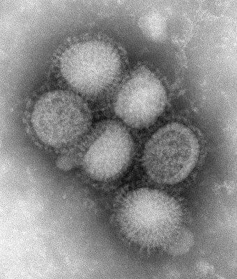 H1N1 : quelques commentaires sur le traitement de l'information concernant la grippe A